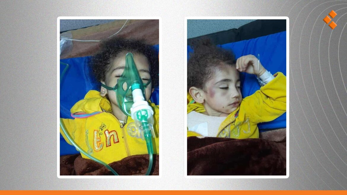 50% من خلايا دماغها توقفت.. طفلة تدخل بغيبوبة بعد تعرضها لضرب من زوجة أبيها في دمشق