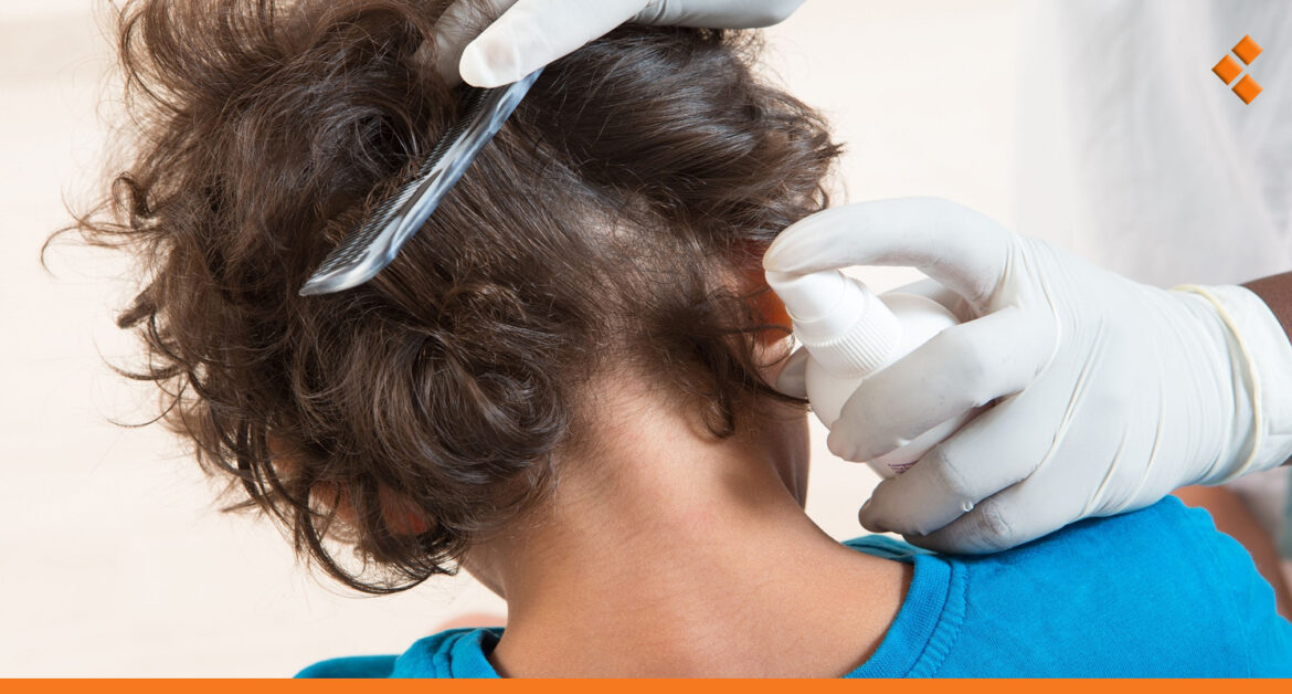 "رغم انتشاره في مدارس الغوطة".. الصحة المدرسية تنفي إغلاق صفوف بسبب القمل بريف دمشق