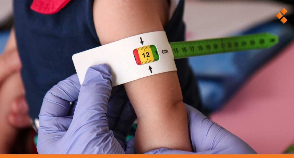 مصدر بمشفى الأطفال: حالات سوء التغذية ترتفع 20% عن العام الفائت!