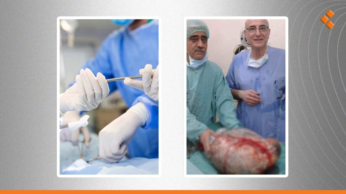 استئصال ورم بوزن 13 كيلو من بطن شابة في مدينة الحسكة