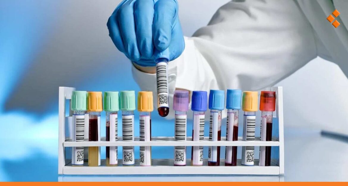 "أثر" يرصد أسعار التحاليل الطبية بعد سقوط النظام